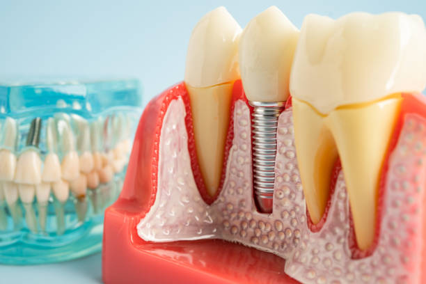 Best Dental Studio in East Port Orchard, WA